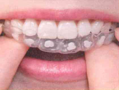 マウストレーの装着